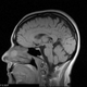 Illustration for article titled Brain Scans Can Access Your Memories